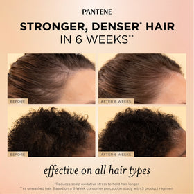 Pantene Abundant & Strong Scalp & Root Hair Serum with Niacinamide 2 oz