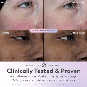 Olay Super Serum, 5-in-1 Skin Enhancing Face Serum, 1.0 oz, For Brightening Dull or Dry Skin